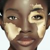 Vitiligo Girl Face Art Diamond Paintings
