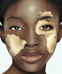 Vitiligo Girl Face Art Diamond Paintings